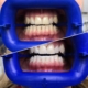 отбеливание зубов системой ZOOM 4